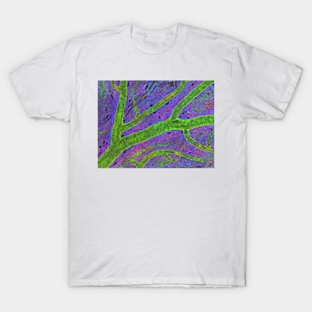 Retina blood vessel (P424/0240) T-Shirt by SciencePhoto